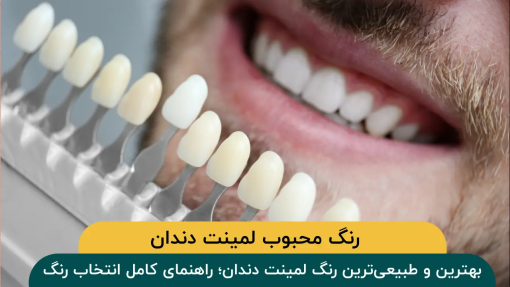 بهترین-رنگ-لمینت-دندان